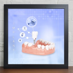 it311-임플란트_인테리어액자大